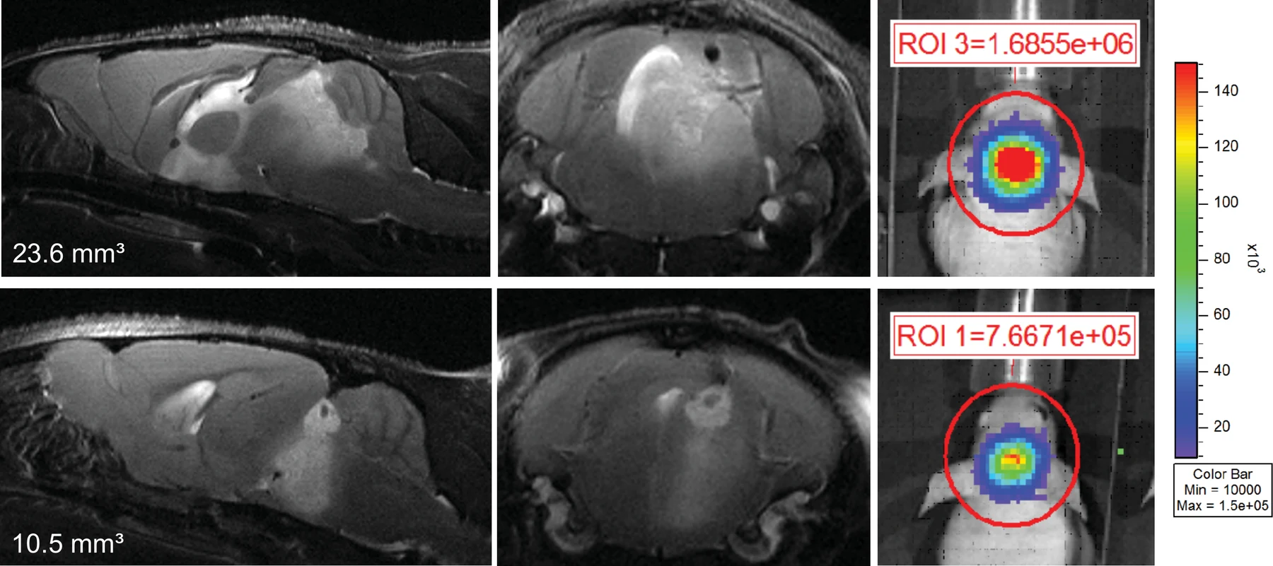 Orthotopic mouse tumors imaged two ways: sagittal and axial MRI with tumor volumes marked, beside bioluminescence maps with the signal quantified inside a drawn region of interest.