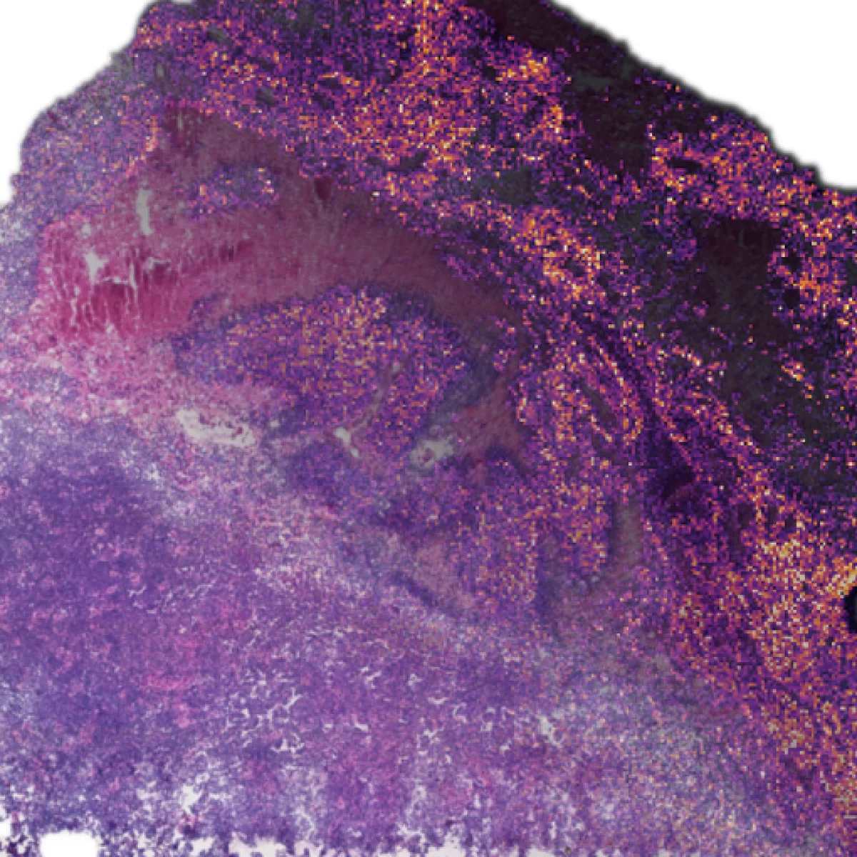 One tissue section shown two ways at once: an H and E stain in pink and purple at the lower left gives way across a diagonal to a spatial transcriptomic map of the same section, in violet and orange, at the upper right.