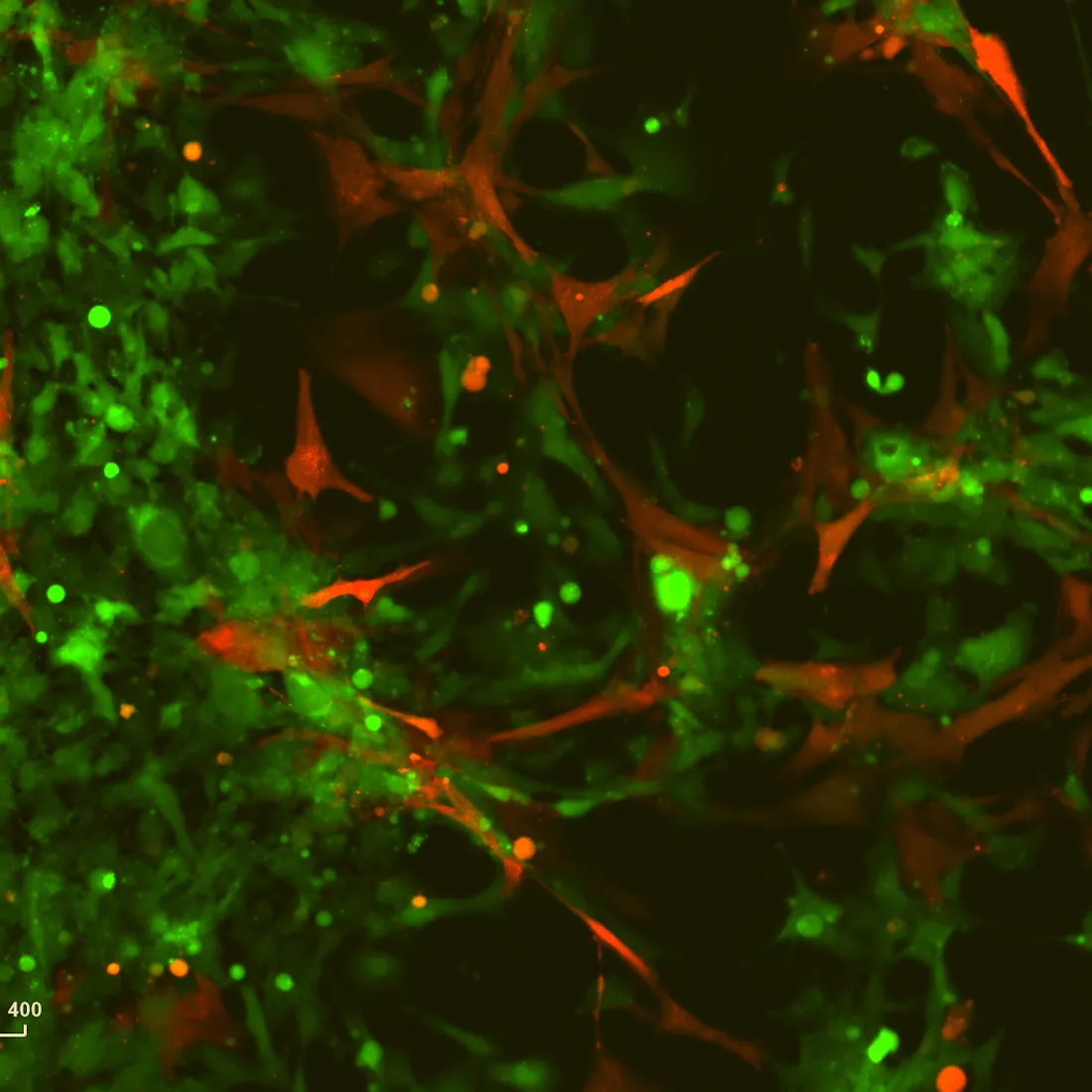 Second fluorescence microscopy field of the same preparation, shown smaller for comparison.