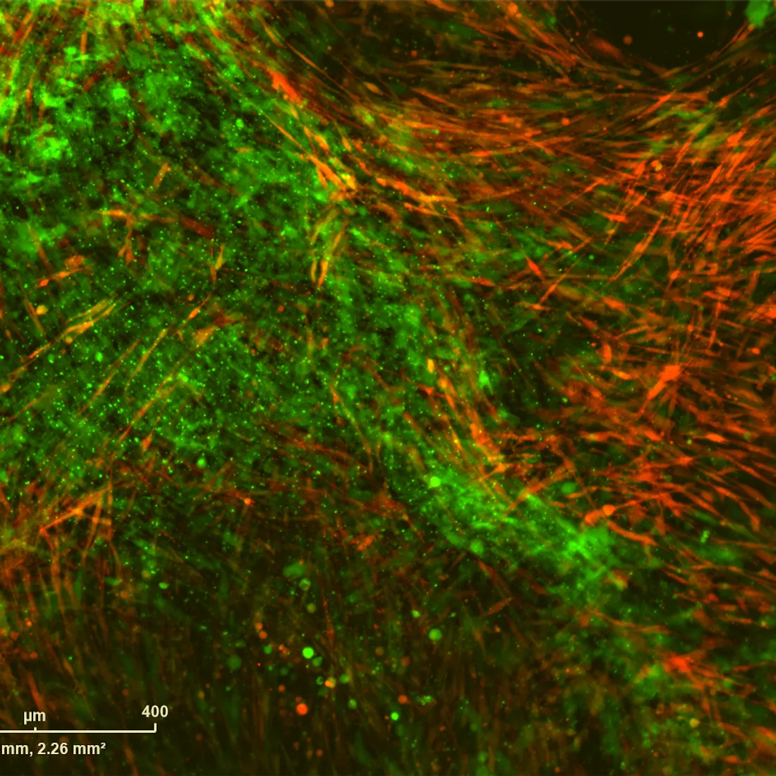 Fluorescence microscopy field showing dense green-labelled cells crossed by streaming red-labelled processes.