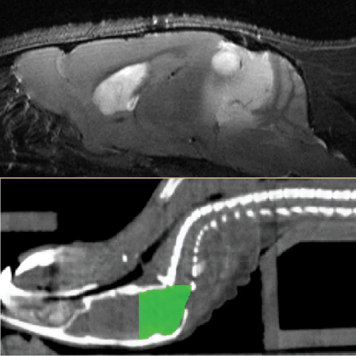 Two images meeting at a gold line inside a circle. Above, a sagittal MRI of a mouse head showing bright lesions within the brain. Below, a CT section of the same anatomy with the radiation treatment volume shaded solid green.